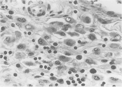 https://cdn.ncbi.nlm.nih.gov/pmc/blobs/9a6f/1374325/6646b18cd3c6/gut00555-0157-c.jpg