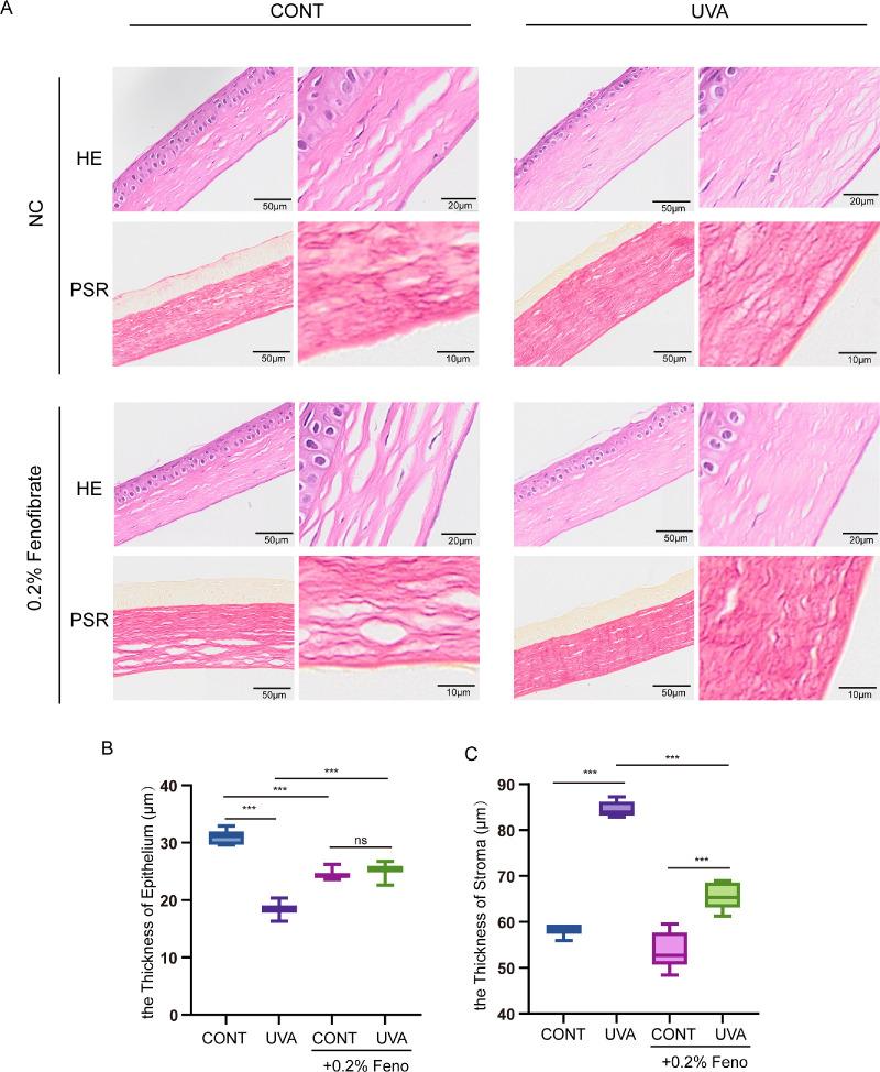 https://cdn.ncbi.nlm.nih.gov/pmc/blobs/9a70/12007668/20d1ee222216/iovs-66-4-36-f005.jpg