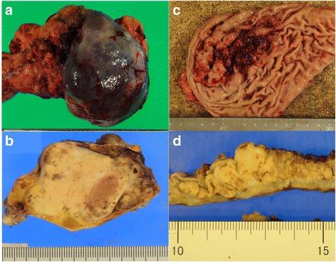 https://cdn.ncbi.nlm.nih.gov/pmc/blobs/9a74/5371532/29092a25ac99/40792_2017_326_Fig2_HTML.jpg