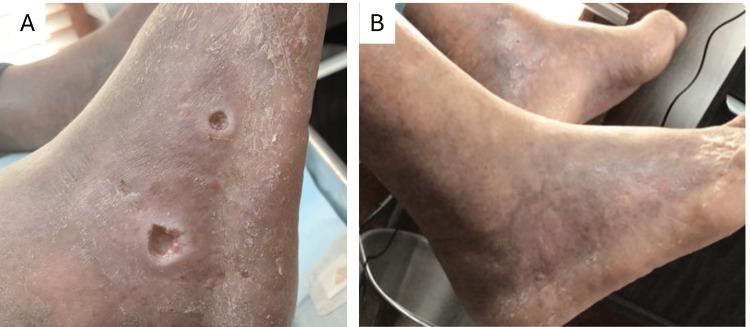 https://cdn.ncbi.nlm.nih.gov/pmc/blobs/9a75/12326212/57b0ad6f406b/cureus-0017-00000089352-i02.jpg