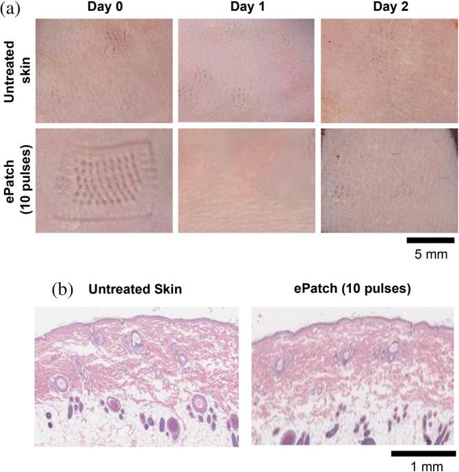 https://cdn.ncbi.nlm.nih.gov/pmc/blobs/9a7b/11256137/82b1865d5ada/BTM2-9-e10662-g001.jpg