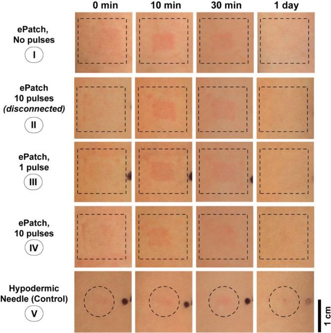 https://cdn.ncbi.nlm.nih.gov/pmc/blobs/9a7b/11256137/f6704850159d/BTM2-9-e10662-g002.jpg