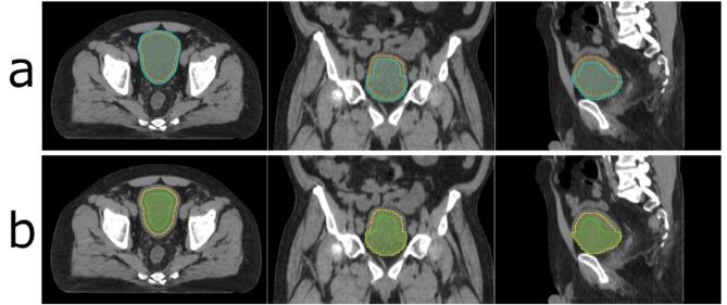 https://cdn.ncbi.nlm.nih.gov/pmc/blobs/9a7d/11618765/ba5c29a338d5/41598_2024_81167_Fig4_HTML.jpg