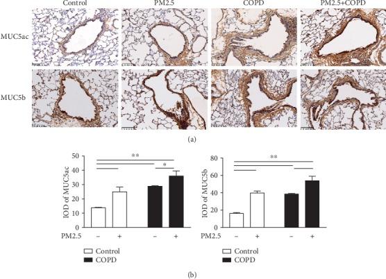 https://cdn.ncbi.nlm.nih.gov/pmc/blobs/9a7f/7231193/6709d71679fe/MI2020-4260204.007.jpg