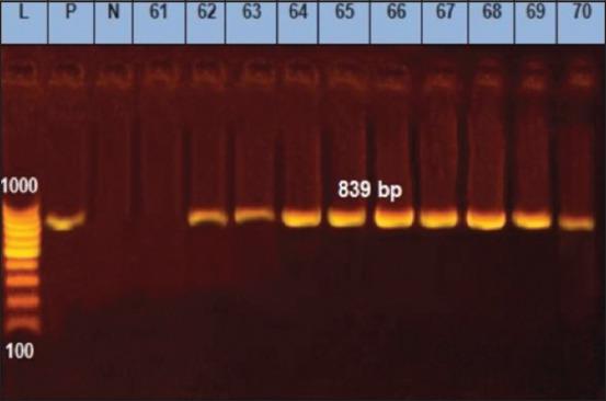 https://cdn.ncbi.nlm.nih.gov/pmc/blobs/9a7f/7896886/ee61035d76c6/Vetworld-14-144-g004.jpg