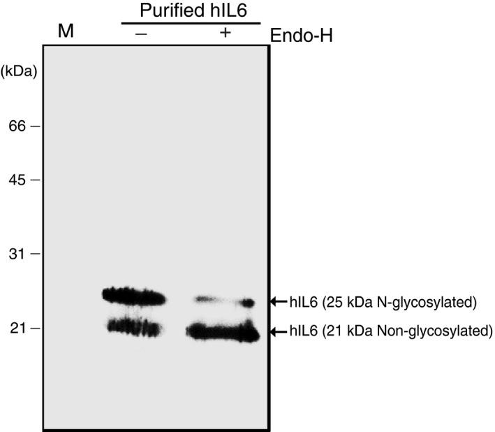 https://cdn.ncbi.nlm.nih.gov/pmc/blobs/9a80/11386861/d234137232cb/PBI-17-1094-g003.jpg
