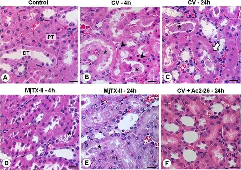 https://cdn.ncbi.nlm.nih.gov/pmc/blobs/9a81/4492549/c51307d1ab04/pone.0130803.g005.jpg
