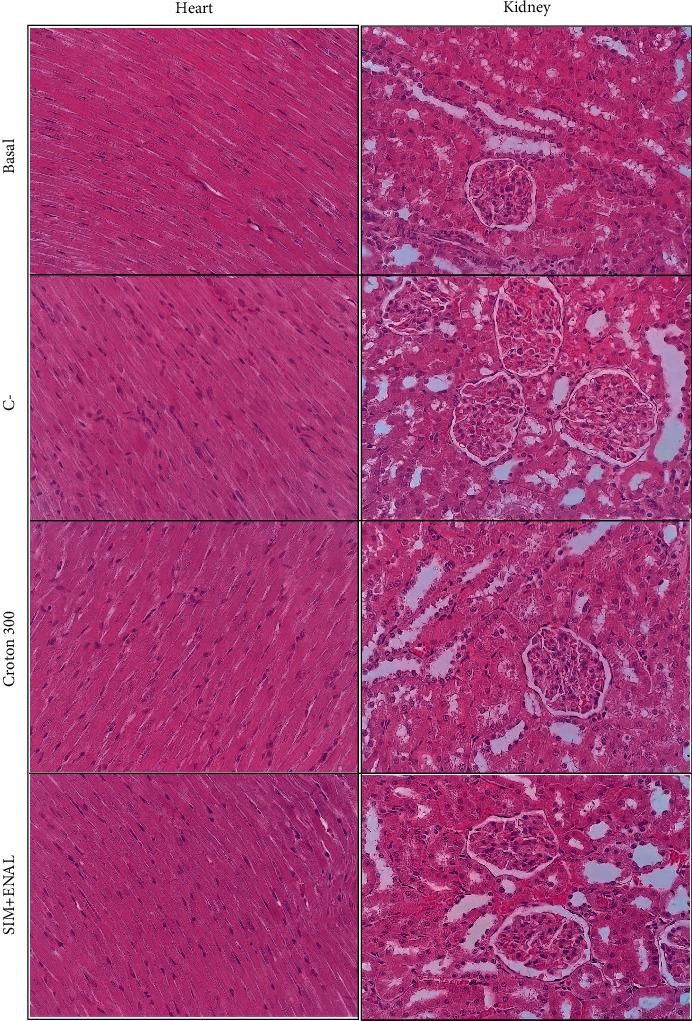 https://cdn.ncbi.nlm.nih.gov/pmc/blobs/9a98/8608512/1234f4ceb062/ECAM2021-6580458.004.jpg