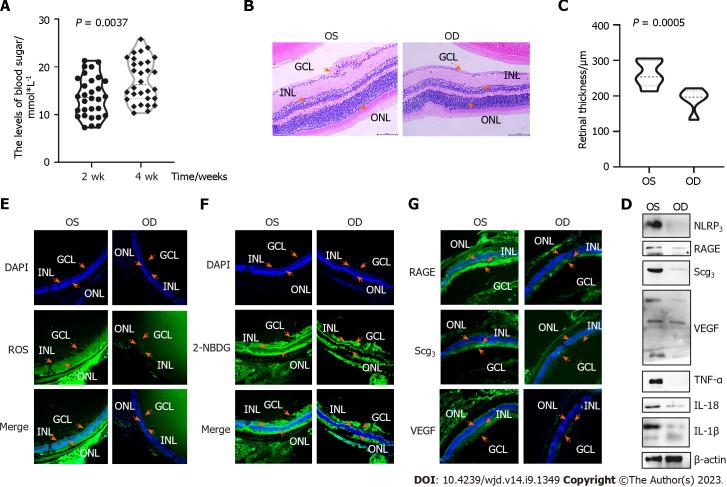 https://cdn.ncbi.nlm.nih.gov/pmc/blobs/9a9b/10523227/1720cee2caef/WJD-14-1349-g004.jpg