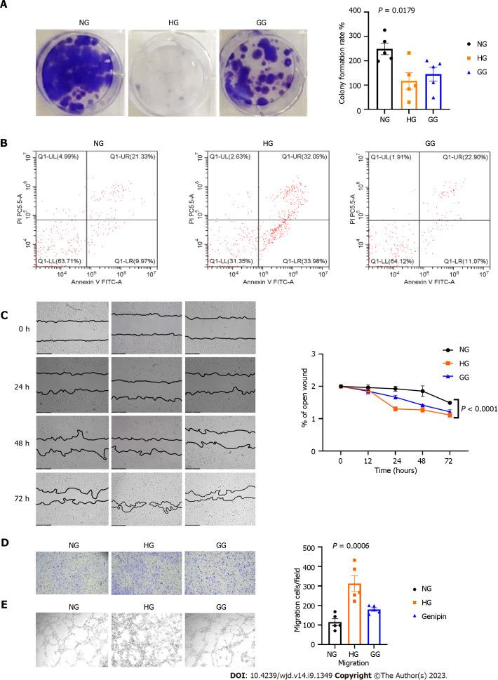 https://cdn.ncbi.nlm.nih.gov/pmc/blobs/9a9b/10523227/1ff56ca36035/WJD-14-1349-g002.jpg