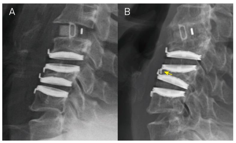 https://cdn.ncbi.nlm.nih.gov/pmc/blobs/9a9c/10971363/106839cfd7b7/jcm-13-01589-g004.jpg