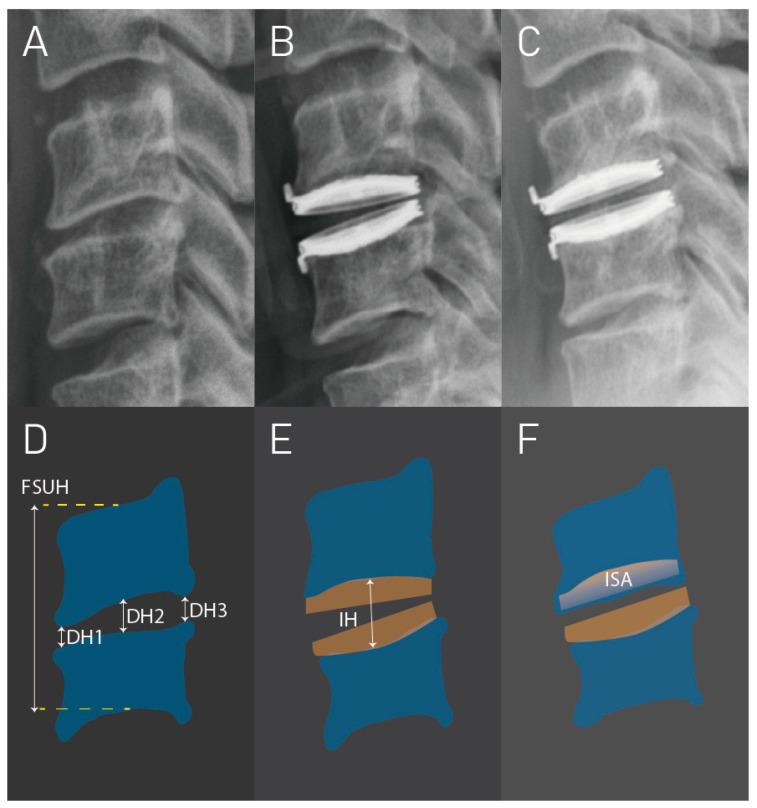 https://cdn.ncbi.nlm.nih.gov/pmc/blobs/9a9c/10971363/399375daf20a/jcm-13-01589-g001.jpg