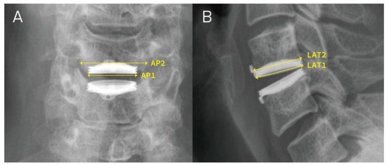 https://cdn.ncbi.nlm.nih.gov/pmc/blobs/9a9c/10971363/8c4d5b18069e/jcm-13-01589-g002.jpg