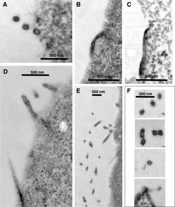 https://cdn.ncbi.nlm.nih.gov/pmc/blobs/9a9d/3907034/142466801445/1742-4690-10-143-8.jpg