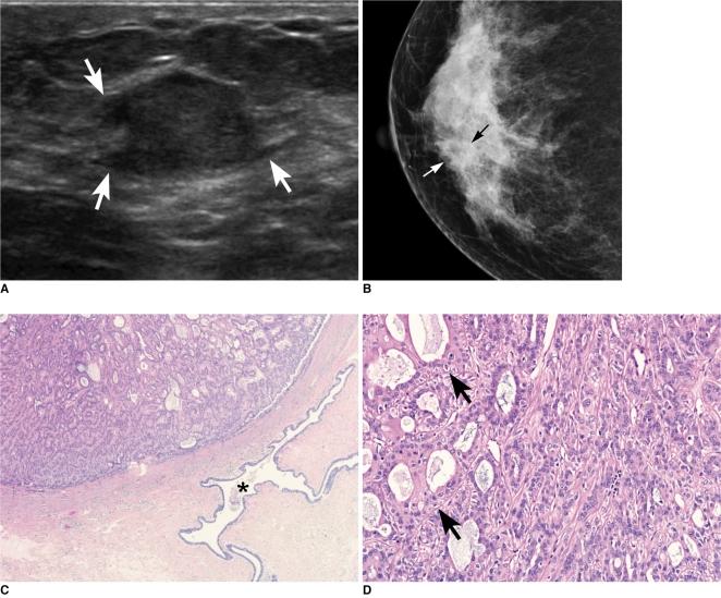 https://cdn.ncbi.nlm.nih.gov/pmc/blobs/9aa0/2930160/ed6ee6c867e3/kjr-11-522-g003.jpg