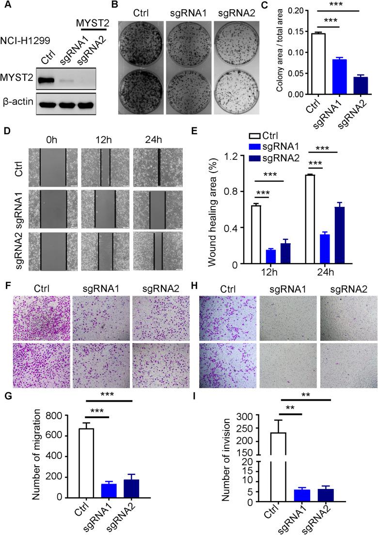 https://cdn.ncbi.nlm.nih.gov/pmc/blobs/9aa5/11629335/0f9eefe2b66e/gr3.jpg