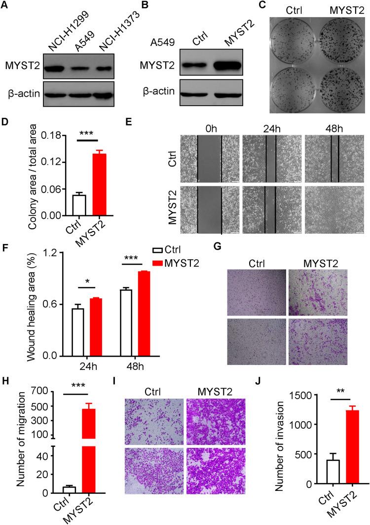 https://cdn.ncbi.nlm.nih.gov/pmc/blobs/9aa5/11629335/70dc2a7bd183/gr2.jpg