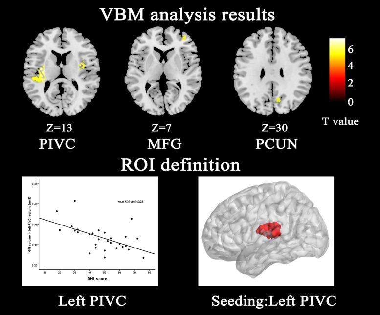 https://cdn.ncbi.nlm.nih.gov/pmc/blobs/9aa5/8297163/500e85e7ba76/fnins-15-683802-g001.jpg