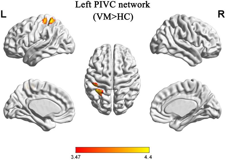https://cdn.ncbi.nlm.nih.gov/pmc/blobs/9aa5/8297163/c9a87633a72a/fnins-15-683802-g002.jpg