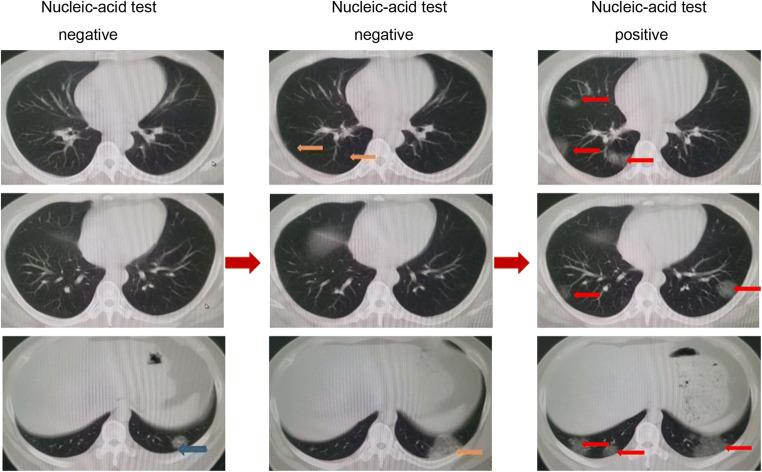 https://cdn.ncbi.nlm.nih.gov/pmc/blobs/9aab/8270861/4ce4d6f3e761/330_2021_7715_Fig5_HTML.jpg