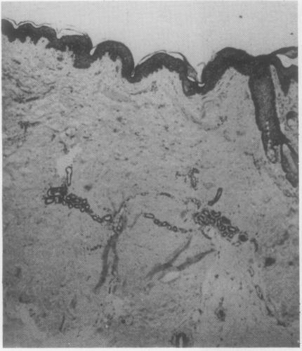 https://cdn.ncbi.nlm.nih.gov/pmc/blobs/9aac/1001581/8b00489c631b/annrheumd00257-0030-a.jpg