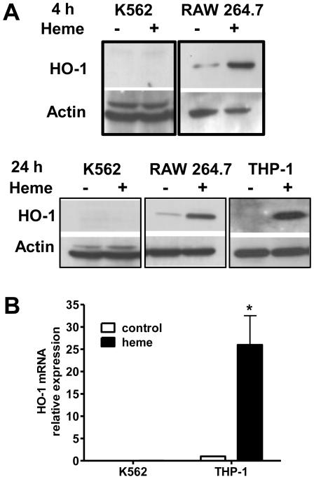 https://cdn.ncbi.nlm.nih.gov/pmc/blobs/9aae/3135583/112d25803bfb/pone.0021358.g002.jpg