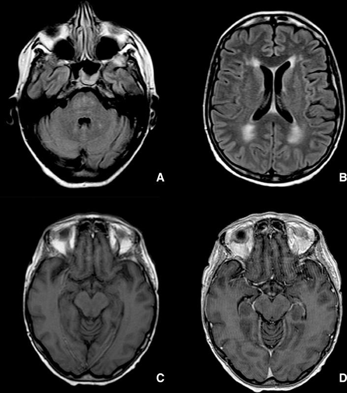 https://cdn.ncbi.nlm.nih.gov/pmc/blobs/9aae/6545363/4c05358ba45f/gr3.jpg