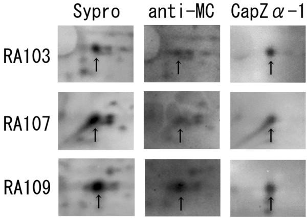 https://cdn.ncbi.nlm.nih.gov/pmc/blobs/9ab0/1794520/0c49599de323/ar2085-2.jpg