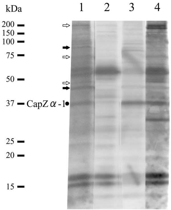 https://cdn.ncbi.nlm.nih.gov/pmc/blobs/9ab0/1794520/dfa5e9a56ab5/ar2085-6.jpg