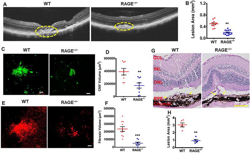 https://cdn.ncbi.nlm.nih.gov/pmc/blobs/9ab4/12161369/b6a3ce05928e/iovs-66-6-30-f001.jpg