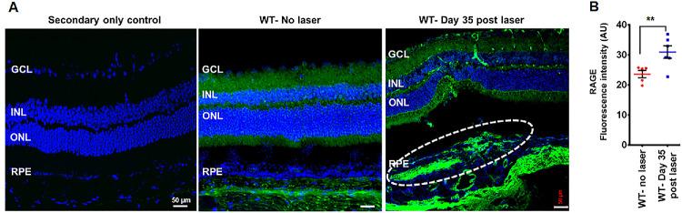 https://cdn.ncbi.nlm.nih.gov/pmc/blobs/9ab4/12161369/d435f6e3af6a/iovs-66-6-30-f002.jpg