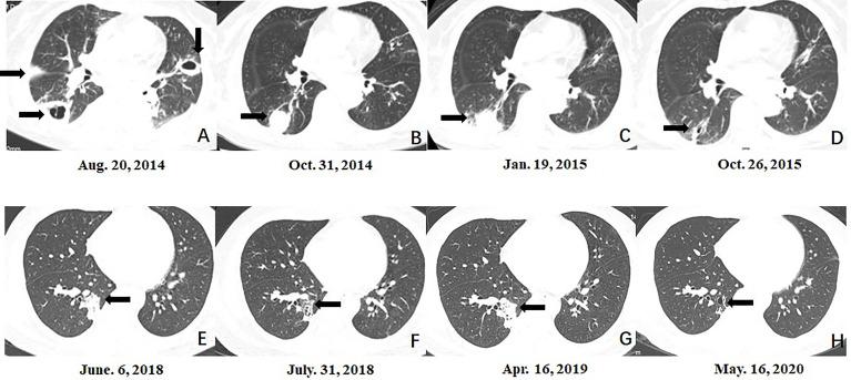 https://cdn.ncbi.nlm.nih.gov/pmc/blobs/9ab5/8930925/36492347dd42/fcimb-12-851891-g001.jpg