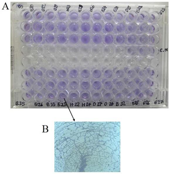 https://cdn.ncbi.nlm.nih.gov/pmc/blobs/9ab9/6004634/e50aa0bc19d7/IJM-10-51-g001.jpg