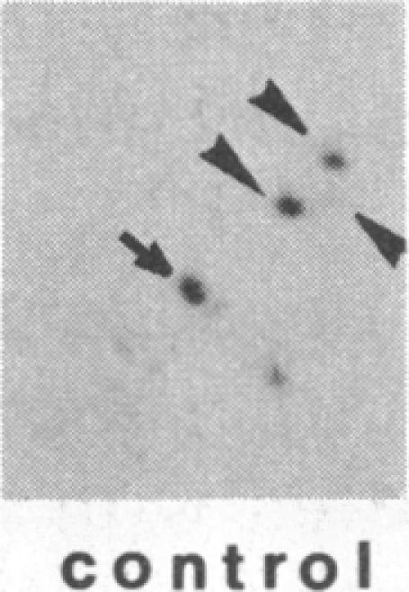 https://cdn.ncbi.nlm.nih.gov/pmc/blobs/9ac2/323310/d0577505fb4e/pnas00312-0154-b.jpg