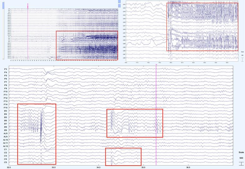 https://cdn.ncbi.nlm.nih.gov/pmc/blobs/9ac6/11972483/80cbe63319e9/12967_2025_6414_Fig1_HTML.jpg