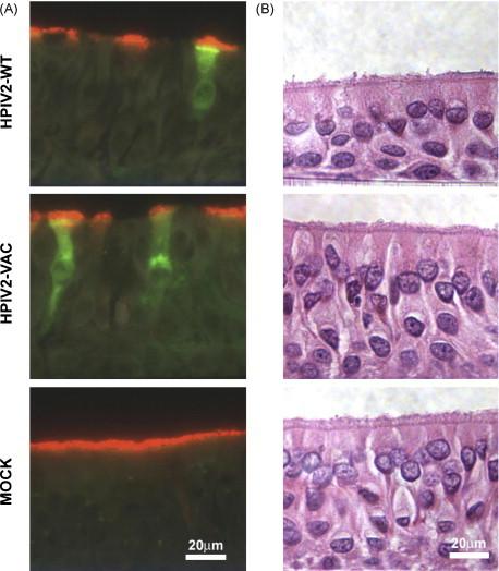 https://cdn.ncbi.nlm.nih.gov/pmc/blobs/9ac8/7126223/7cd8142d3baa/gr4.jpg