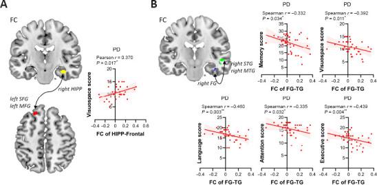 https://cdn.ncbi.nlm.nih.gov/pmc/blobs/9ac8/9827791/012e68e94194/NRR-18-1154-g005.jpg