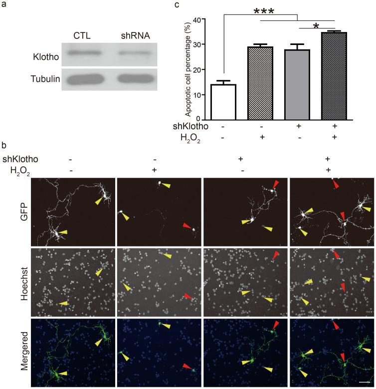 https://cdn.ncbi.nlm.nih.gov/pmc/blobs/9ad1/4284502/6ccd51d4dfcc/srep07645-f4.jpg