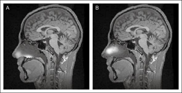 https://cdn.ncbi.nlm.nih.gov/pmc/blobs/9ad2/4320758/ed52199f2093/head0055-0088-f1.jpg