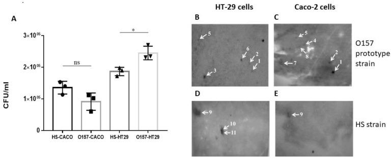 https://cdn.ncbi.nlm.nih.gov/pmc/blobs/9ade/9863631/8b5f5a57187a/vaccines-11-00175-g001.jpg