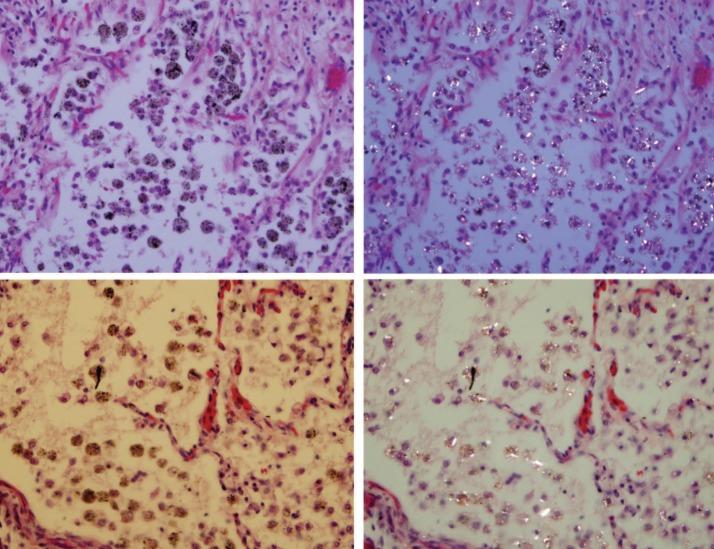 https://cdn.ncbi.nlm.nih.gov/pmc/blobs/9adf/6679630/8d470952962b/ijoem-8-153-g001.jpg