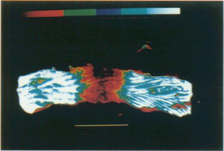 https://cdn.ncbi.nlm.nih.gov/pmc/blobs/9ae5/2033889/5155a185d93a/brjcancer00043-0075-a.jpg