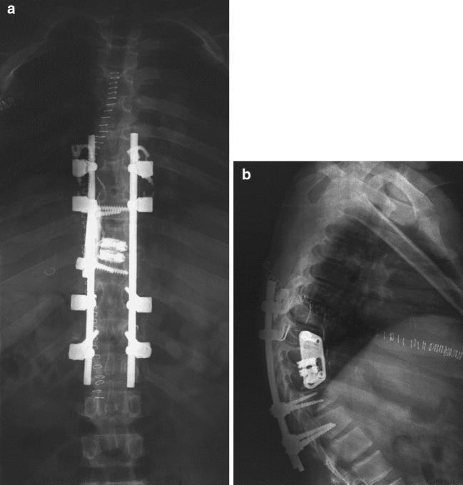 https://cdn.ncbi.nlm.nih.gov/pmc/blobs/9ae8/2336830/2b443bd34bfd/586_2005_53_Fig4_HTML.jpg