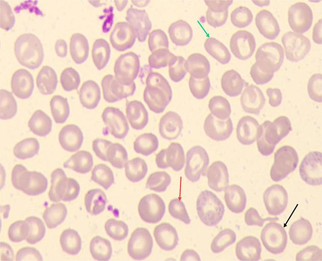 https://cdn.ncbi.nlm.nih.gov/pmc/blobs/9aea/11317050/0cdfd416da86/JBM-15-351-g0002.jpg
