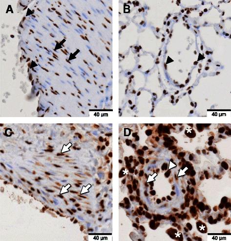 https://cdn.ncbi.nlm.nih.gov/pmc/blobs/9af2/4248446/4f1ee4dac98f/12931_2014_148_Fig3_HTML.jpg