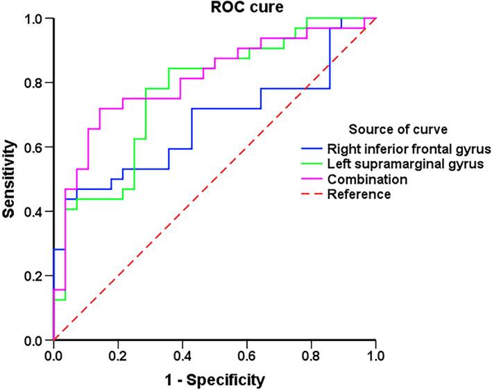 https://cdn.ncbi.nlm.nih.gov/pmc/blobs/9af5/10651975/9efd707cb685/CNS-29-4070-g002.jpg