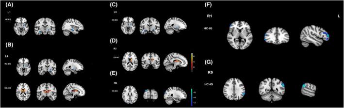 https://cdn.ncbi.nlm.nih.gov/pmc/blobs/9af5/10651975/a26d3d562af1/CNS-29-4070-g006.jpg