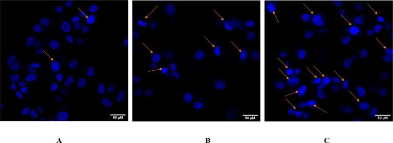 https://cdn.ncbi.nlm.nih.gov/pmc/blobs/9af5/10911732/8dbb159e0f6d/APJCP-25-201-g005.jpg