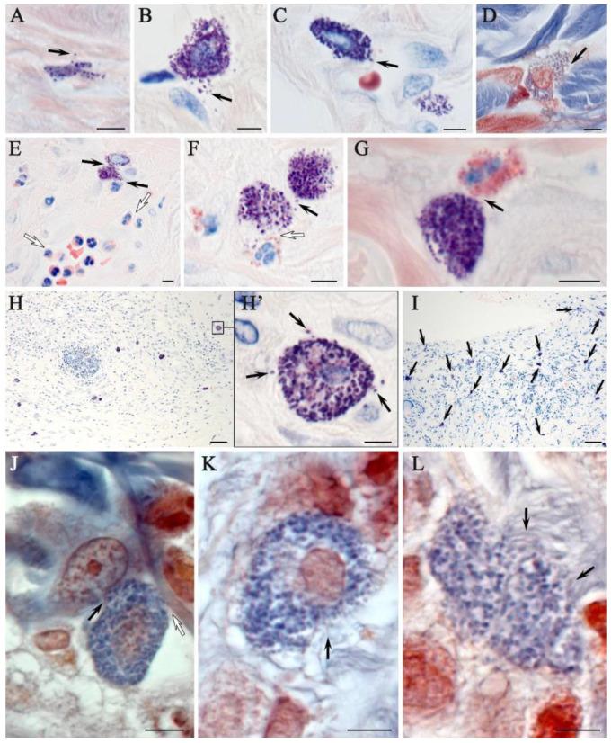 https://cdn.ncbi.nlm.nih.gov/pmc/blobs/9af5/11900442/00e9c542940b/ijms-26-01994-g007.jpg