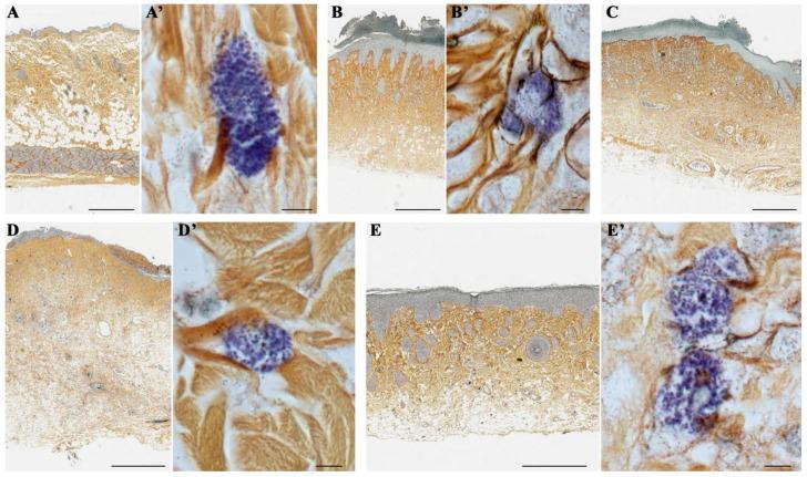 https://cdn.ncbi.nlm.nih.gov/pmc/blobs/9af5/11900442/ebfbeda2a609/ijms-26-01994-g006.jpg